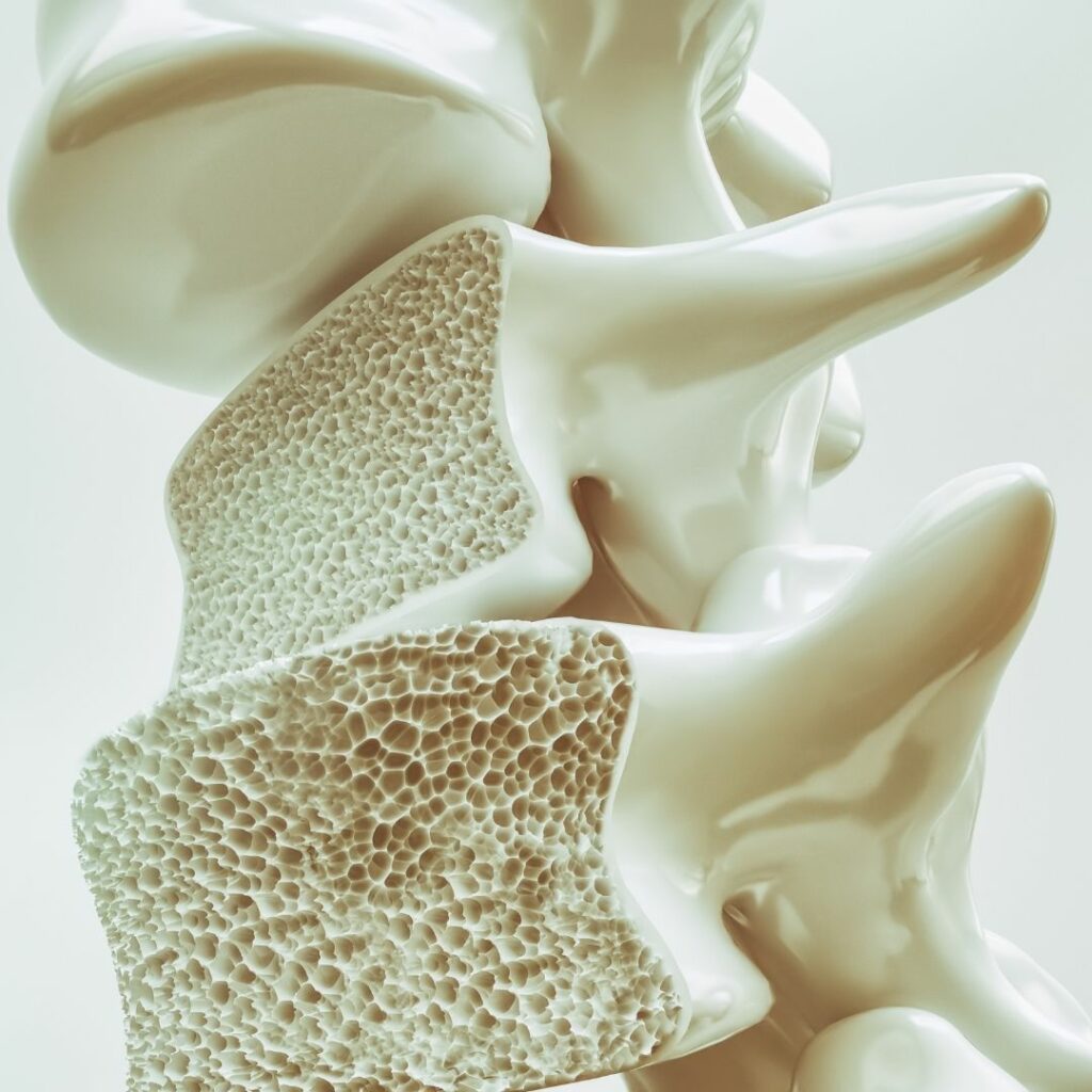 Bone Density of Spine
