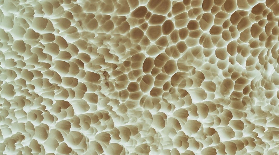 Porous bone as seen from microscope.