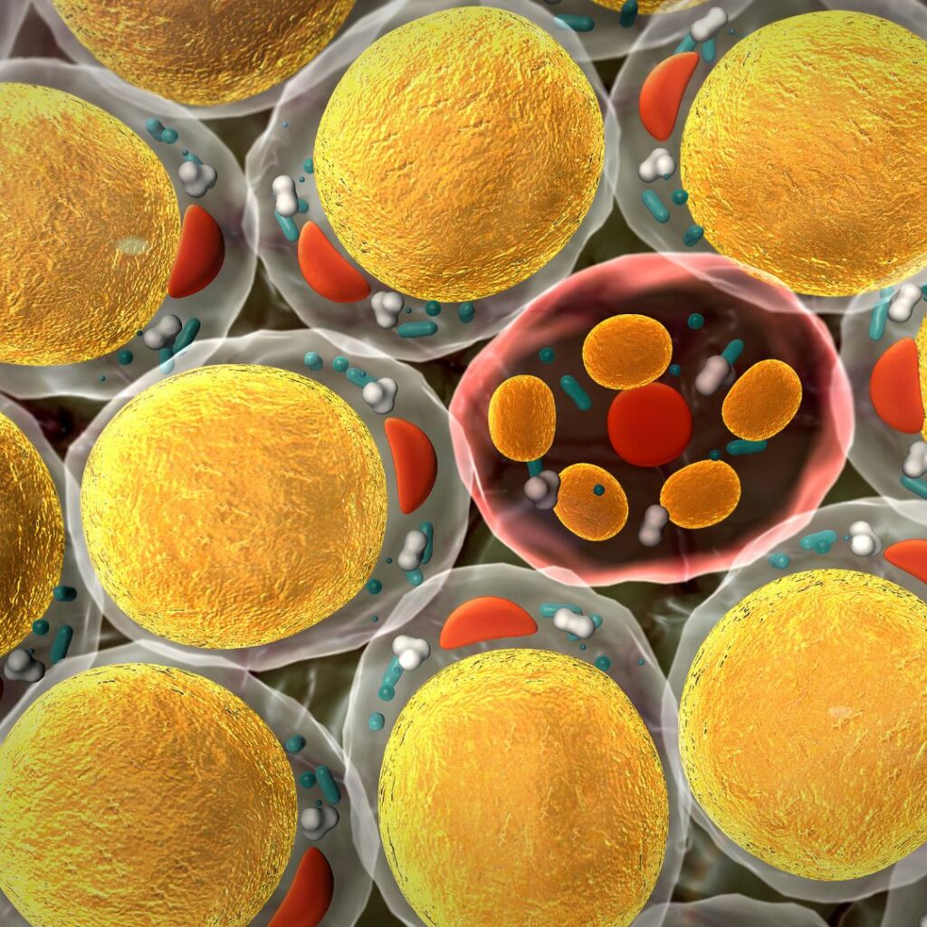 Overfull fat cells (adipocytes) contribute to systemic inflammation.