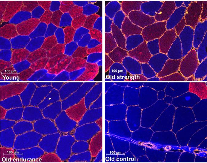 Microscopy of fast twitch fibers in young and elderly