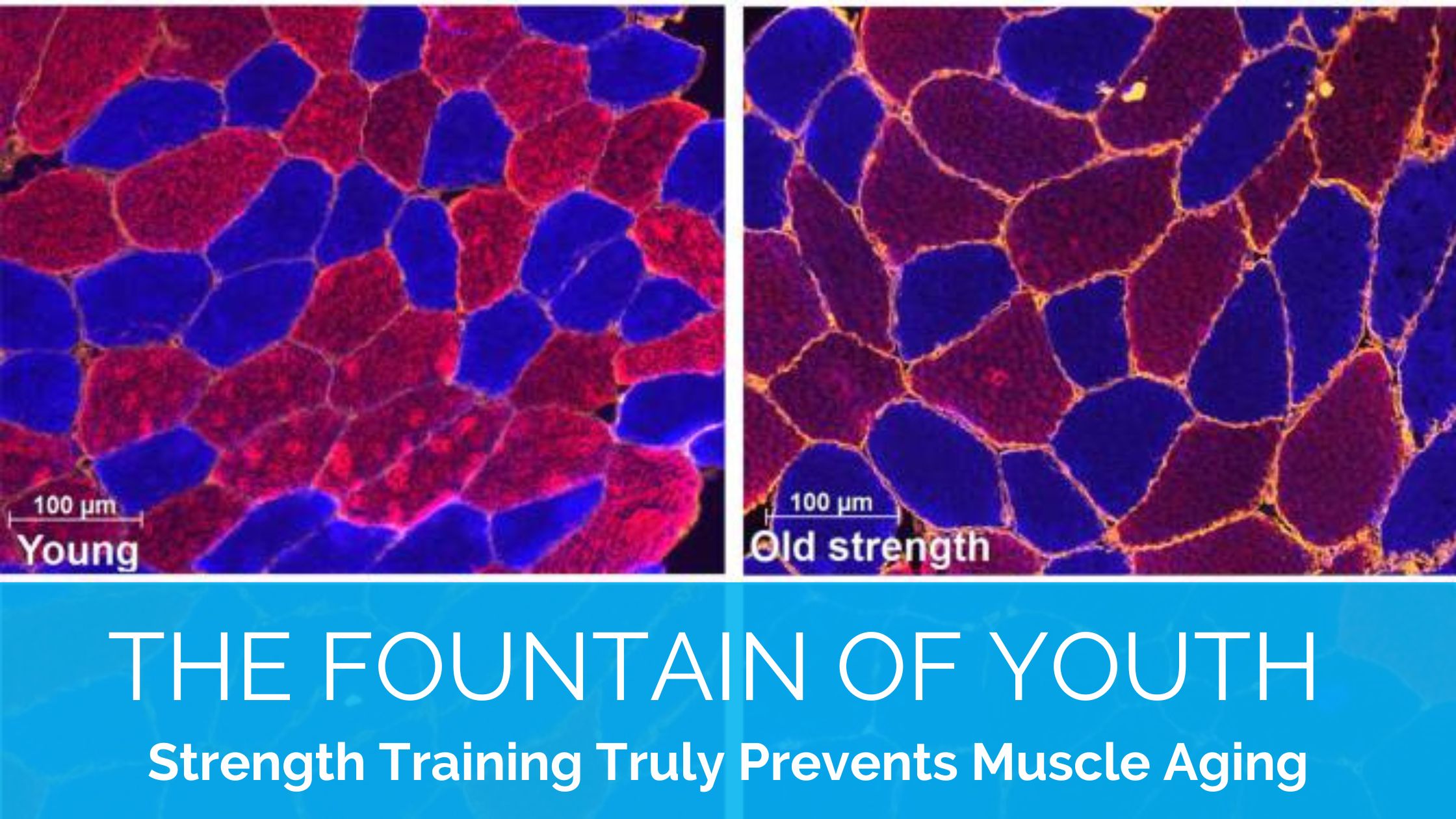 Strength Training Prevents Muscle Aging